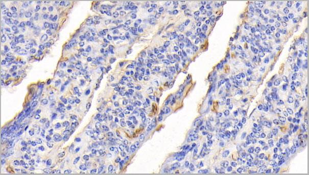 product-image-AAA21251_IHC.jpg