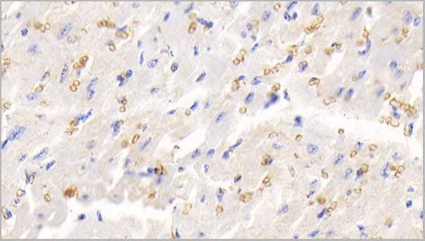 product-image-AAA21251_IHC2.jpg