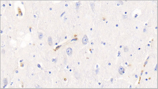 product-image-AAA21251_IHC3.jpg