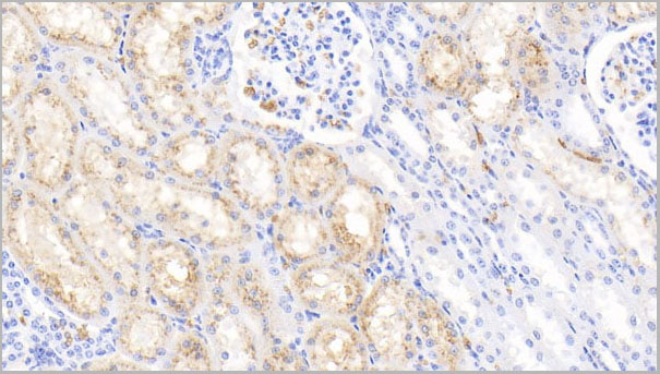 product-image-AAA21251_IHC4.jpg