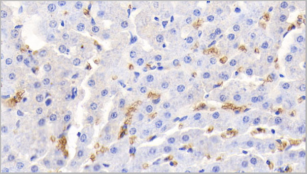 product-image-AAA21251_IHC5.jpg