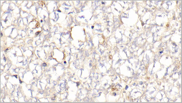 product-image-AAA21251_IHC6.jpg