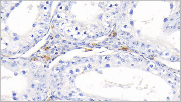 product-image-AAA21251_IHC7.jpg