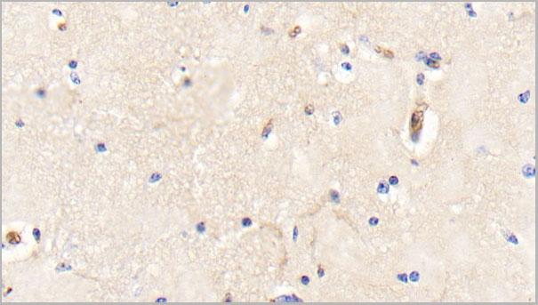 product-image-AAA21251_IHC8.jpg
