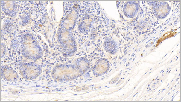 product-image-AAA21251_IHC9.jpg