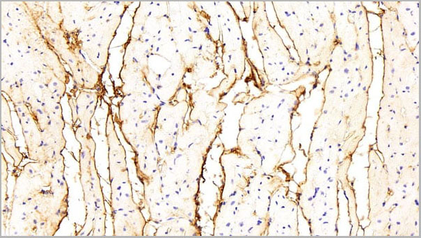 product-image-AAA21252_IHC4.jpg