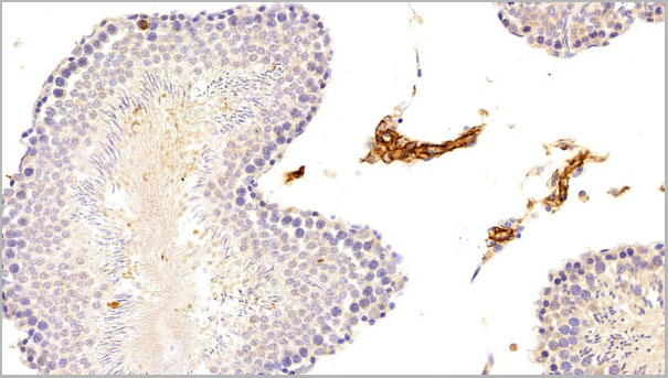 product-image-AAA21252_IHC6.jpg
