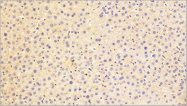 product-image-AAA21252_IHC7.jpg