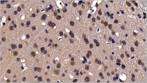product-image-AAA21253_IHC.jpg