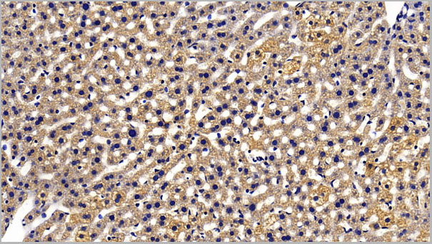 product-image-AAA21253_IHC3.jpg
