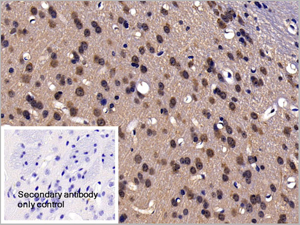 product-image-AAA21253_IHC5.jpg