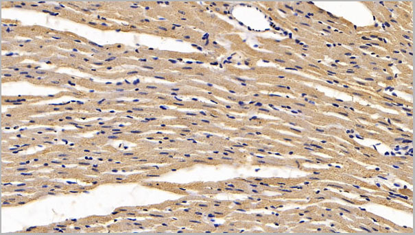 product-image-AAA21254_IHC2.jpg