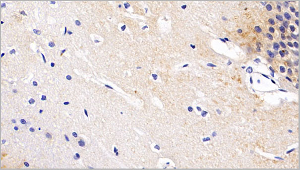 product-image-AAA21255_IHC.jpg