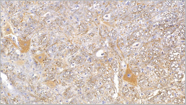 product-image-AAA21255_IHC2.jpg