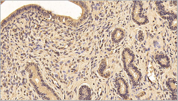 product-image-AAA21256_IHC2.jpg