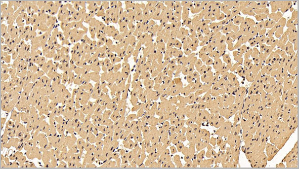 product-image-AAA21256_IHC3.jpg