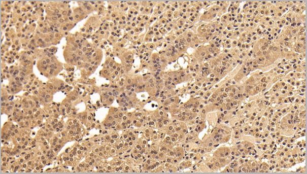 product-image-AAA21256_IHC5.jpg