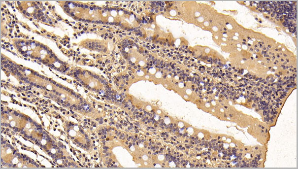 product-image-AAA21256_IHC6.jpg