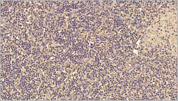 product-image-AAA21256_IHC7.jpg