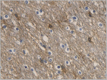 product-image-AAA21257_IHC.jpg