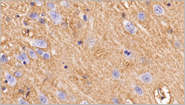 product-image-AAA21257_IHC3.jpg