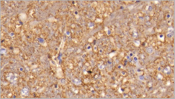 product-image-AAA21257_IHC4.jpg