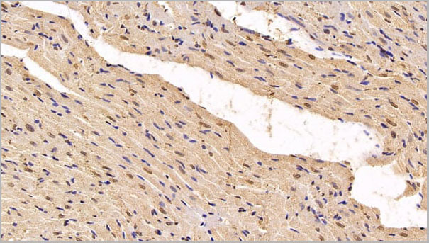 product-image-AAA21259_IHC4.jpg