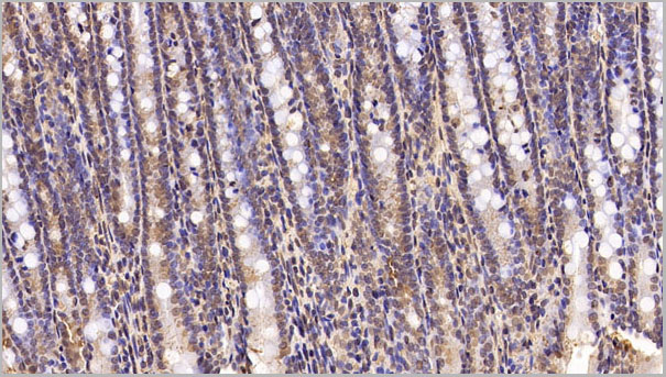 product-image-AAA21259_IHC5.jpg