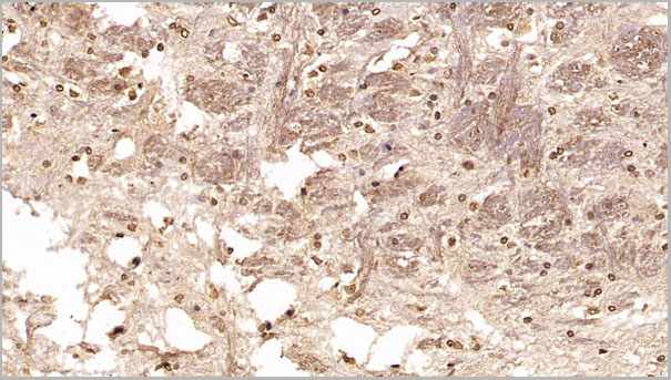 product-image-AAA21259_IHC7.jpg