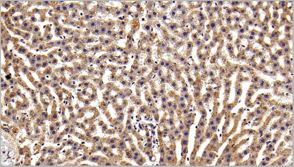 product-image-AAA21260_IHC.jpg