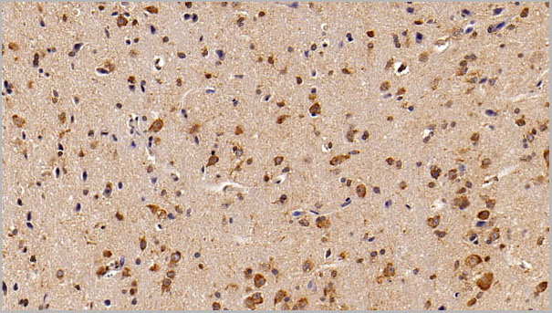 product-image-AAA21260_IHC3.jpg