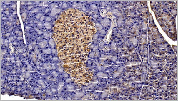 product-image-AAA21260_IHC4.jpg