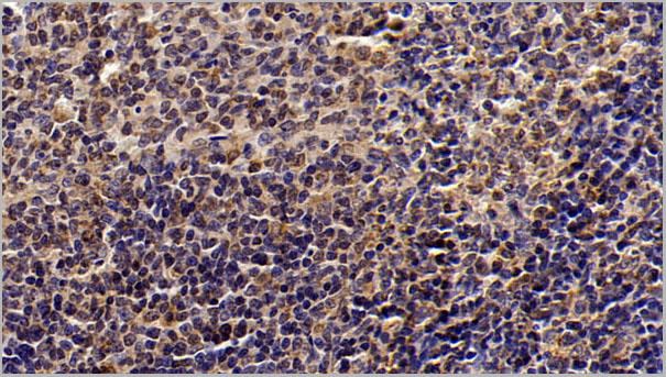 product-image-AAA21260_IHC5.jpg