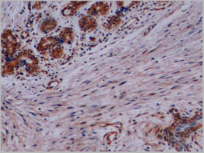product-image-AAA21261_IHC3.jpg