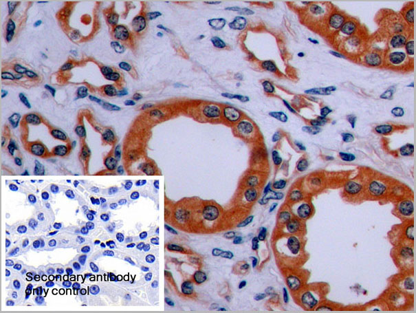 product-image-AAA21261_IHC6.jpg
