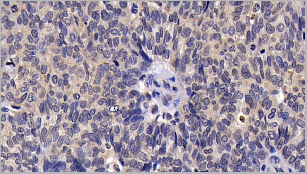 product-image-AAA21262_IHC.jpg