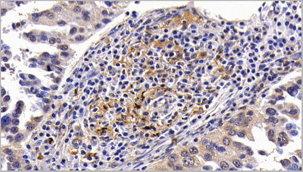 product-image-AAA21262_IHC2.jpg