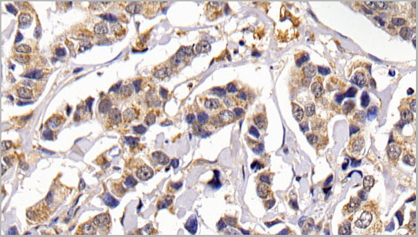 product-image-AAA21262_IHC3.jpg