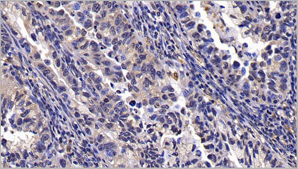 product-image-AAA21262_IHC4.jpg