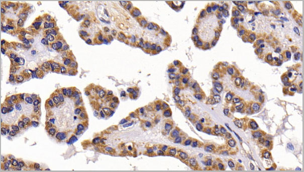 product-image-AAA21262_IHC5.jpg