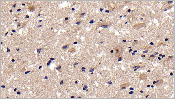product-image-AAA21262_IHC6.jpg