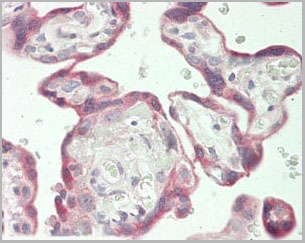 product-image-AAA21269_IHC2.jpg