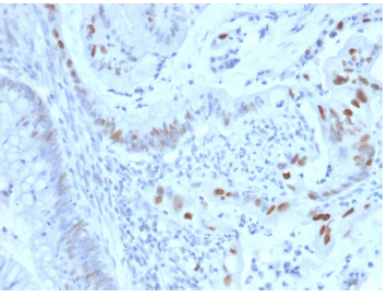 product-image-AAA214568_IHC.png