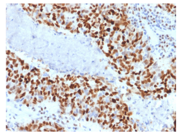 product-image-AAA214568_IHC2.png