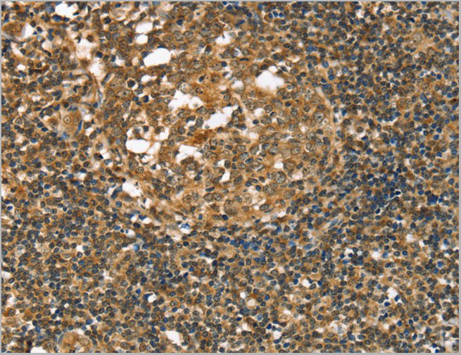 product-image-AAA21996_IHC.jpg