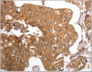 product-image-AAA21997_IHC2.jpg