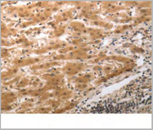 product-image-AAA21997_IHC3.jpg