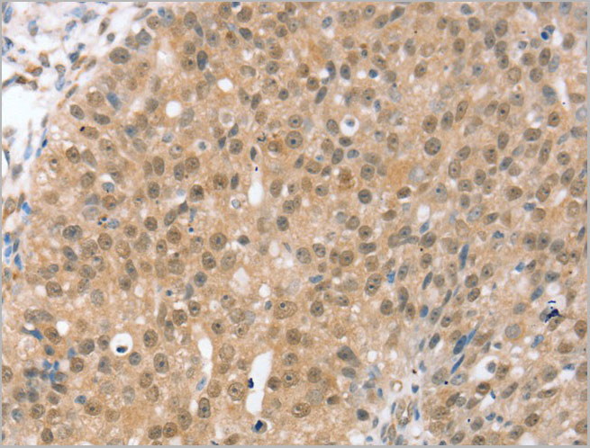 product-image-AAA21998_IHC2.jpg