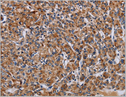 product-image-AAA22000_IHC.jpg