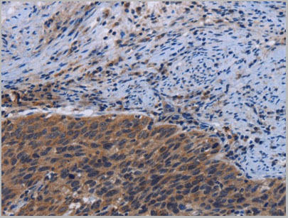 product-image-AAA22000_IHC2.jpg